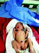 男网友避而不见 重庆女子酒店里产下4斤重男婴