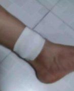 老婆一言不合就动手 重庆小伙被家暴两年