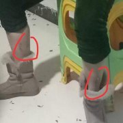 打麻将与人起争执   女子腿部被咬破皮