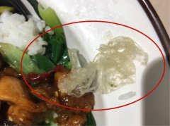 小煎鸡套饭里吃出塑料手套 吓坏食客