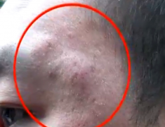 外卖小哥骑车进小区送餐 保安不让进双方大打出手