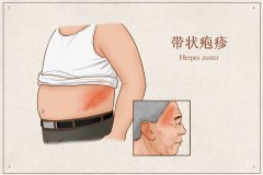 ​这场隐形蛇患，正在“撕咬”他们的健康防线